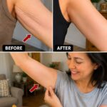 Most people don’t even know how to use garlic to help their…