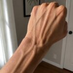 10 Hiatal Hernia Signs and Symptoms You Should Know!