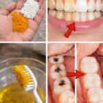 Mix this with Vaseline to look younger.