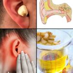 The 6 Best Herbal Infusions to Help Keep Your Arteries Healthy Naturally