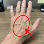 The 10 Metoprolol Side Effects Your Doctor is PRAYING You Don’t Discover