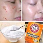 It removes kidney stones, dissolves gravel, and relieves urinary tract infections. I’ll give you the recipe for a simple “ok”.
