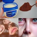 Millions Ignore This Year-Round Virus Until It’s Too Late see more…