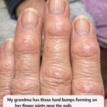 Alert! 8 Drugs That Cause Serious Dementia
