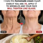 Doctors warn that consuming ginger can cause…