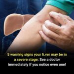 This home remedy surprises everyone: it helps relieve mucus, phlegm and rhinitis…