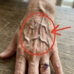 Atorvastatin Side Effects: 15 Lesser-Known Symptoms You Should Watch