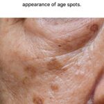 23 Strange Signs Your Kidneys Might Be in Trouble