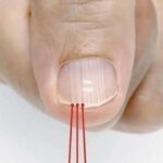 Your Feet Are a “Blood Sugar Meter” – Beware of Diabetes If You Frequently Experience These 12 Symptoms