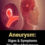 After Gallbladder Removal: 3 Conditions You Could Develop — Why You Should Avoid the Surgery When Possible