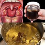 8 Habits You Should Stop This Year If You Are Taking Amlodipine – And Why