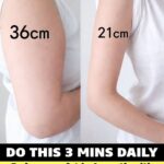 Have you noticed small white spots on your arms or legs… and you don’t know what they are? Here’s what a specialist says check 1st comment