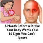 10 Early Signs of Dementia You Should NEVER Ignore!….