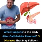 If your veins are visible in your hand, it is a signal of ca… See
