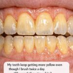 Get rid of all the stuck poop you’ve had in your body for a long time. This will even get rid of the gum you ate in kindergarten