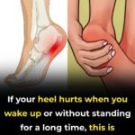 What Happens to the Body After Gallbladder Removal? 3 Diseases That May Follow – Avoid Surgery If Possible