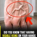 10 Early Warning Signs of a Stroke Everyone Should Know to Take Prompt Action