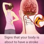 Important Warning from Doctors: Stop Taking Vitamin D Immediately If You Have These 4 Symptoms