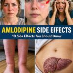 10 Important Side Effects of Metoprolol That You Need to Know