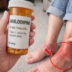 These visible signs may be hiding liver disease