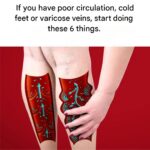 Who Is Most at Risk of Night Cramps?
