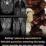 10 Indicators of Blocked Arteries You Shouldn’t Ignore
