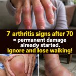 The 10 Metoprolol Side Effects Your Doctor is PRAYING You Don’t Discover