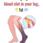 If You Often Get Leg Cramps at Night, Your Body May Be Sending a Warning Sign