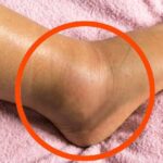 10 Early Signs of Dementia You Should NEVER Ignore!