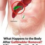 23 Strange Signs Your Kidneys Might Be in Trouble