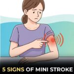 Signs You Have Too Much Blood Sugar ..see more