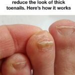 If You Open a Watermelon and See This