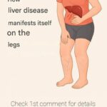 10 Early Warning Signs of a Stroke Everyone Should Know to Take Prompt Action