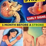 If your veins are visible in your hand, it is a signal of ca… See