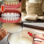 Just One Spoonful and You’ll Be Running to the Bathroom – A Natural Remedy to Relieve Constipation