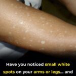 Is Left-Side Sleeping the Secret to Better Health?…
