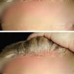 These visible signs may be hiding liver disease