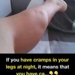 23 Strange Signs Your Kidneys Might Be in Trouble