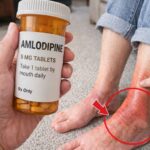 12 Silent Symptoms of High Creatinine Your Doctor Might Miss Until It’s Serious