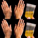If your HANDS fall asleep it’s a clear sign that you have can… see mo