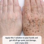 5 Signs of a Mini Stroke in the Elderly