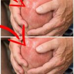 23 Strange Signs Your Kidneys Might Be in Trouble