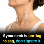 10 Indicators of Blocked Arteries You Shouldn’t Ignore