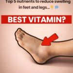 Navigating Vitamin Habits: Understanding Stroke Risk for Older Adults and Brain Health