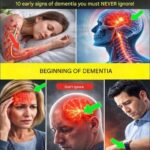 7 Signs of Mini Stroke in The Elderly