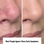7 Signs of Mini Stroke in The Elderly