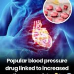 5 Symptoms of a Mini Stroke in Seniors That Shouldn’t Be Ignored