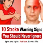 Cholesterol: 5 symptoms that warn you it’s too high(1 / 2)