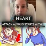 8 Warning Signs of Stroke That May Appear One Month Before and 9 Tips to Prevent It