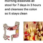 23 Warning Signs Your Kidneys May Be Asking for Help